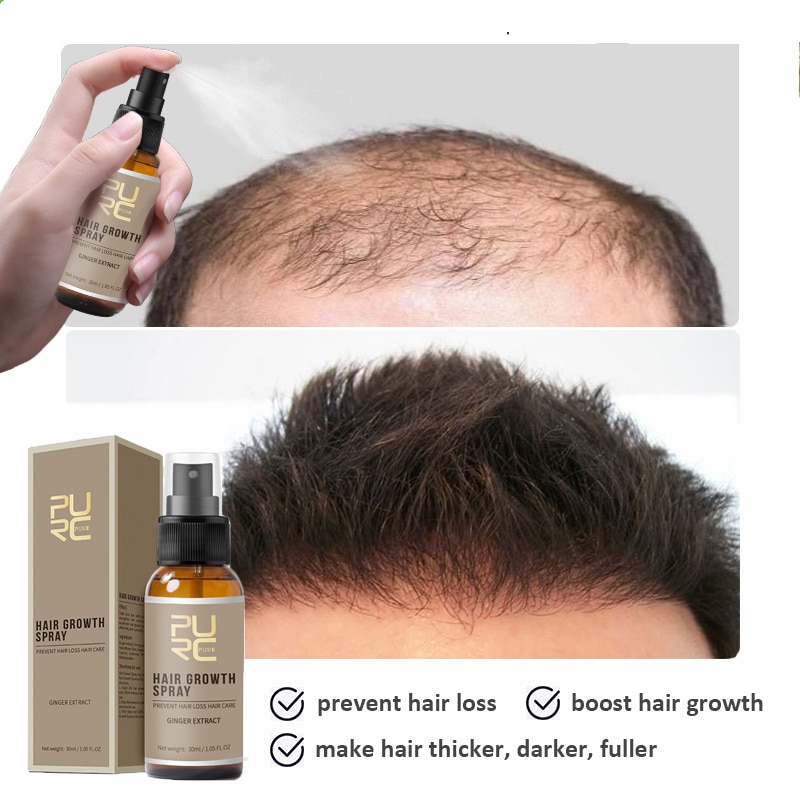 PURC Thickening Hair Shampoo Care Fast Grow Hair Essence Oil Anti Hair Loss Spray For Hair Growth Scalp Treatments Products 5