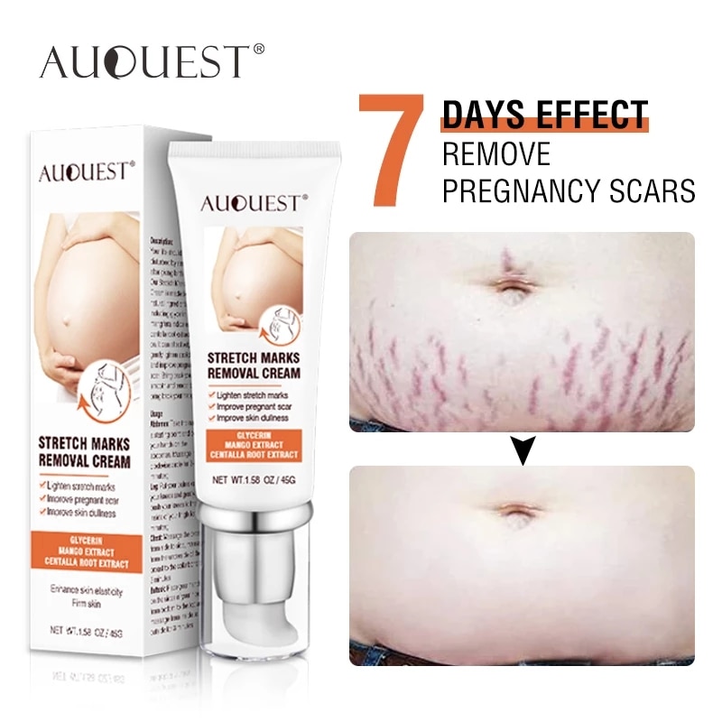 Maternity Stretch Marks Removal Cream Body Buttock Breast Mark Skin Care Effective Anti White Stretch Scar Remover Cream 45g 1