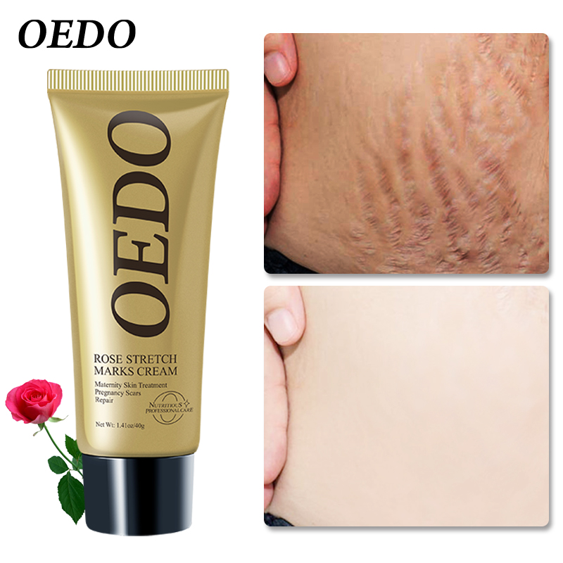 Oedo Rose Removes Stretch Mark Cream